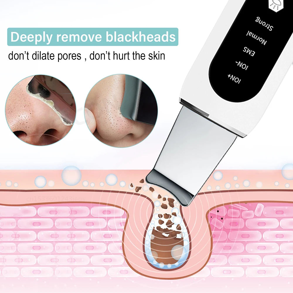 Peeling Blackhead Remover