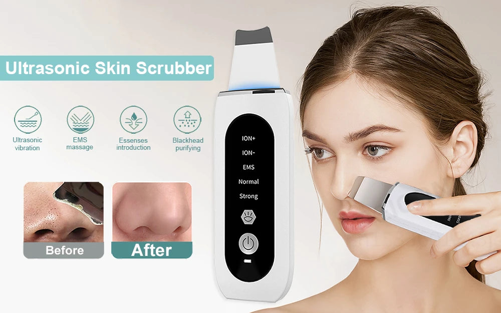 Peeling Blackhead Remover