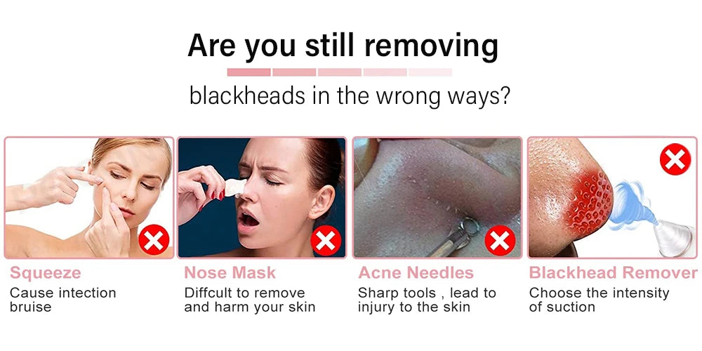Peeling Blackhead Remover