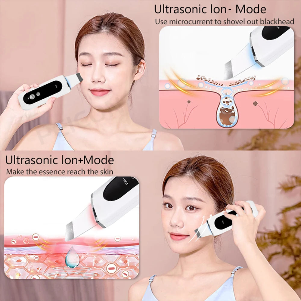 Peeling Blackhead Remover