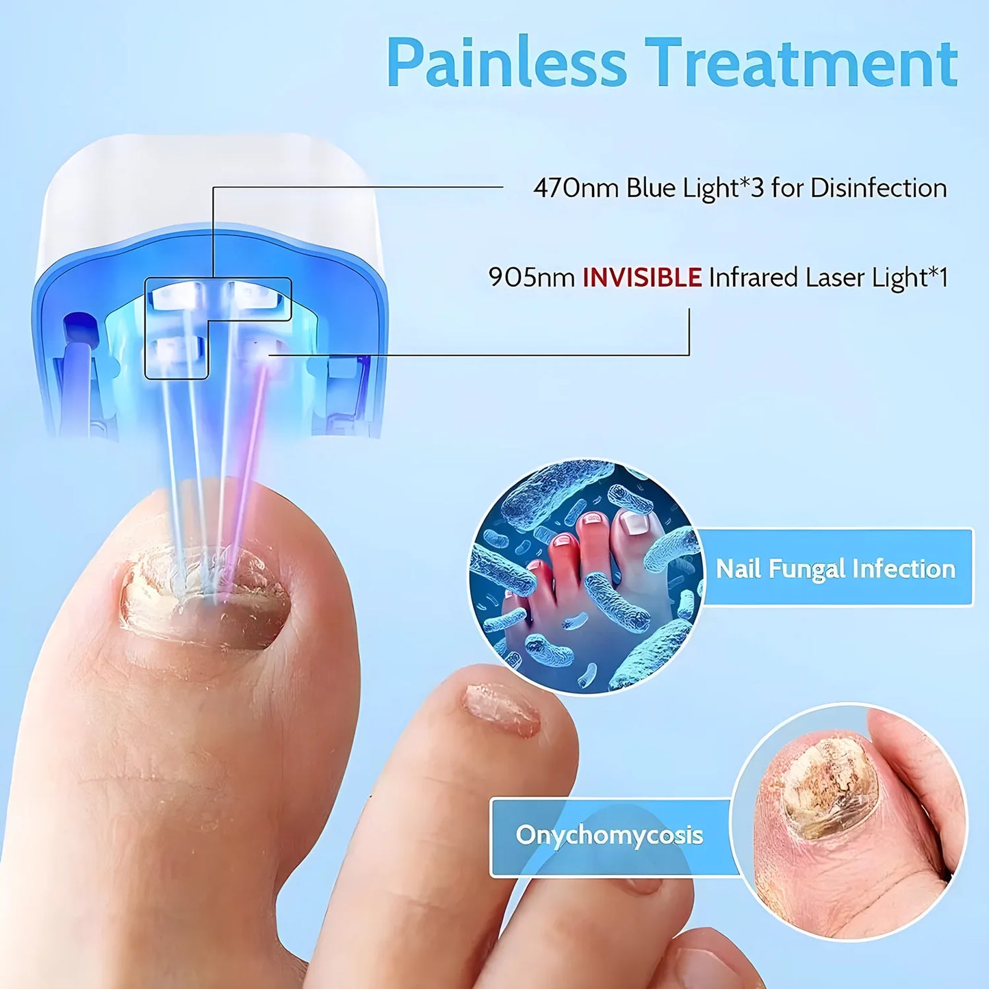 Nail Fungus Cleaning