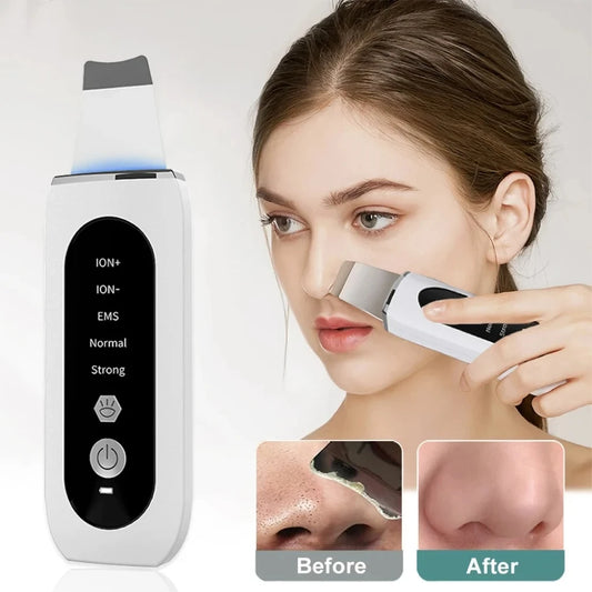 Peeling Blackhead Remover