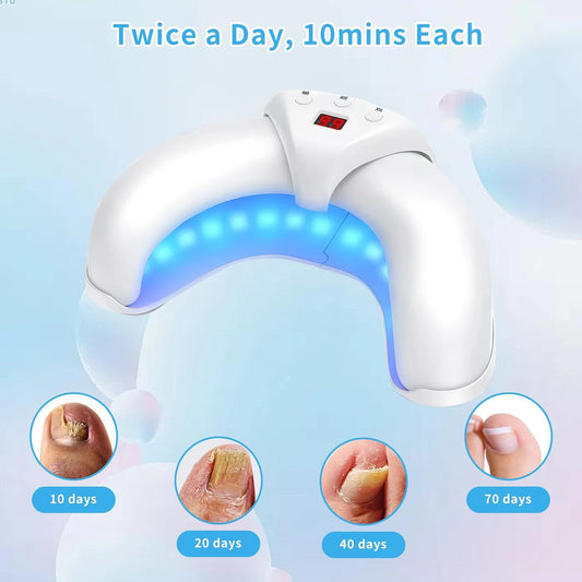 Nail Fungus Laser Treatment